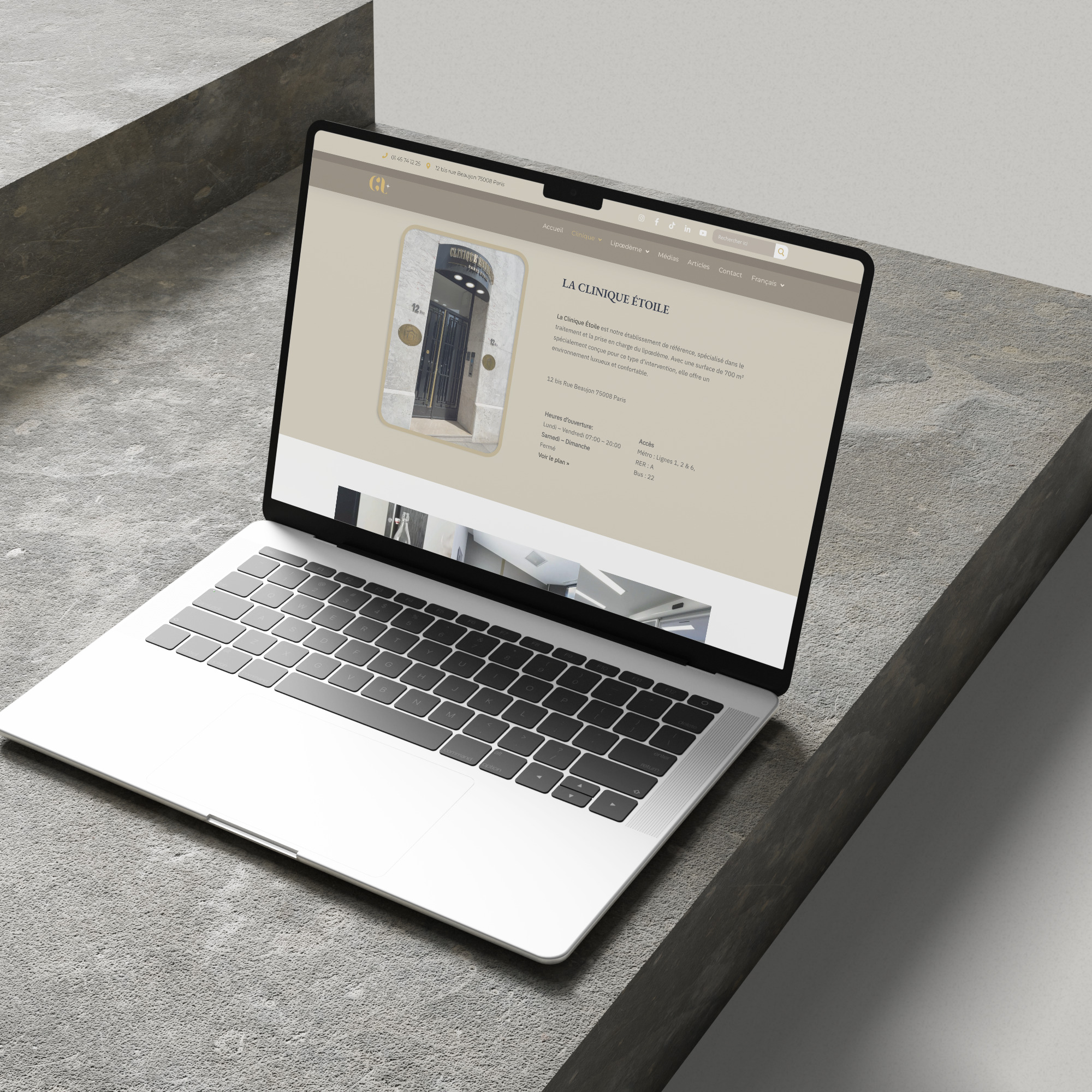 clinique-du-lipoedeme_mockup_laptop_1x1